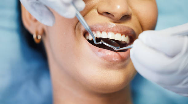 Best Emergency Dental Care for Sports Injuries in Fort Totten, ND